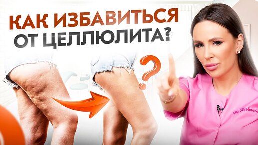 ЭТО 100% обеспечит тебя целлюлитом! Как избавиться от целлюлита?