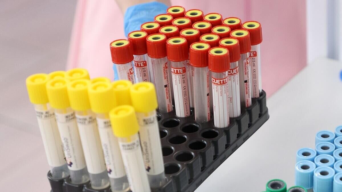    Анализы© Globallookpress Artem Sobolev