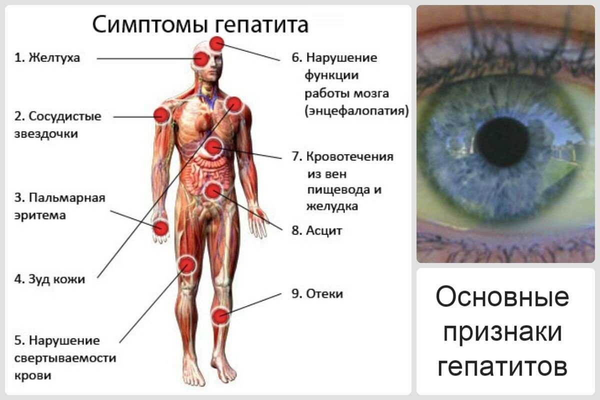  Существует несколько причин, вызывающих хронический гепатит.