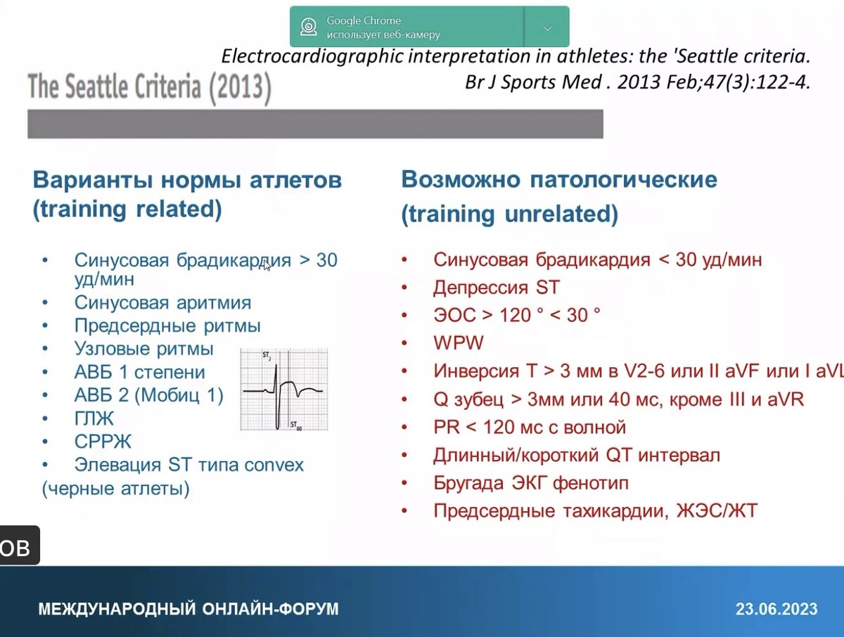 Слайд из материалов лекции на тему "От оценки риска до спасения жизни: как SDS помогает предотвратить смерть у молодых атлетов и детей", представленной в рамках международного онлайн-форума 23.06.23. Докладчик: Макаров Леонид Михайлович (Москва) - Руководитель Центра синкопальных сердечных аритмий (ЦСССА) у детей и подростков, врач-детский кардиолог. Доктор медицинских наук, профессор, врач высшей категории.