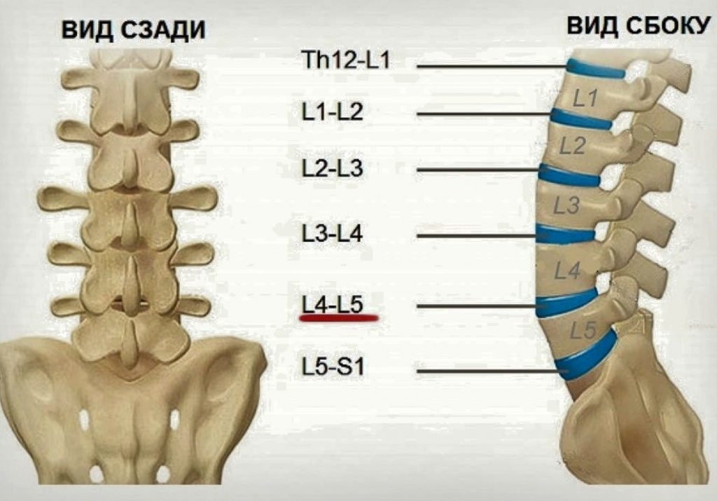 Протрузия l4 l5. Диски позвонков l3-l4, l4-l5, l5-s1. Диск l1-l2 позвоночника. Межпозвонковые диски l1-l2. Диск сегмента l4-l5.