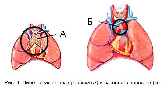 Заболевания вилочковой железы