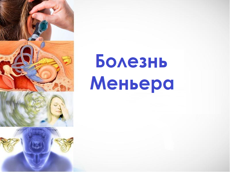 Болезнь Меньера: симптомы, диагностика, методы лечения