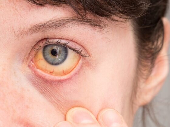 Фото: Shutterstock