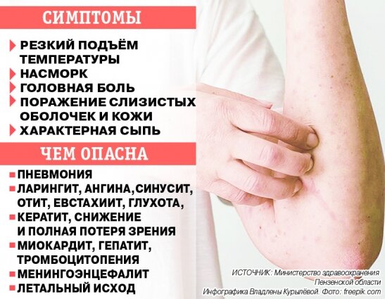    Фото: министерство здравоохранения Пензенской области