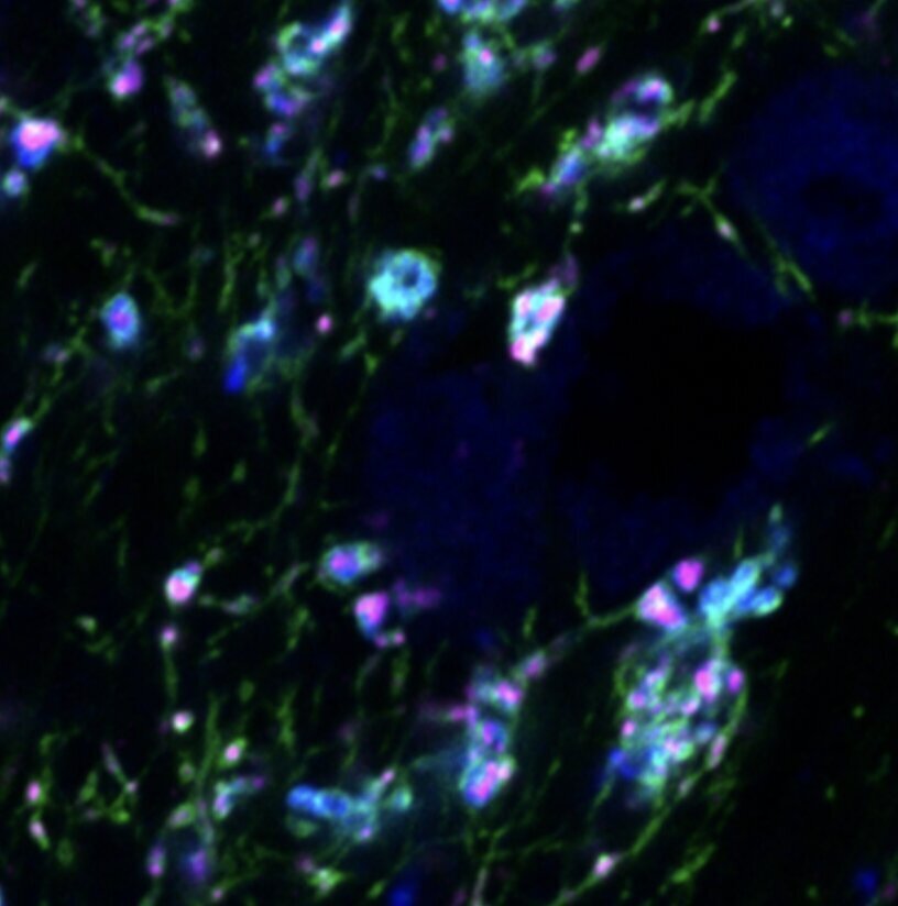     Фото: Jasmine D.S. Reggiani et al./Neuron, 2023 Включение рецептора серотонина на окончаниях нервных клеток в таламусе. Аксоны сетчатки показаны зеленым цветом, пресинаптические окончания показаны синим, а рецепторы серотонина — пурпурным.