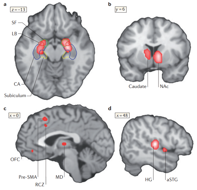 Области мозга, которые активируются при прослушивании музыки