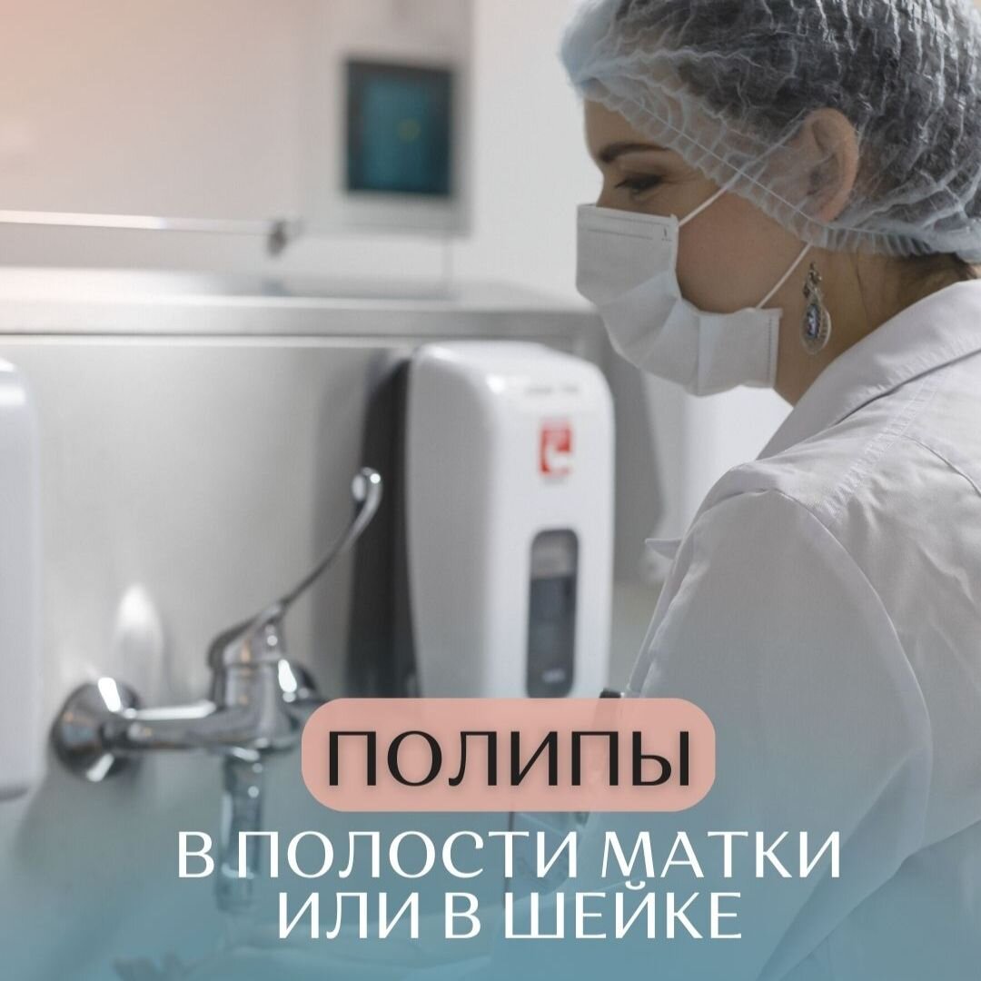 Полипы в полости матки или в шейке | ГИНЕКОЛОГ Ломанова Галина ...