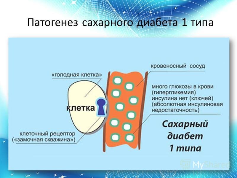 Типы сахарного диабета картинки