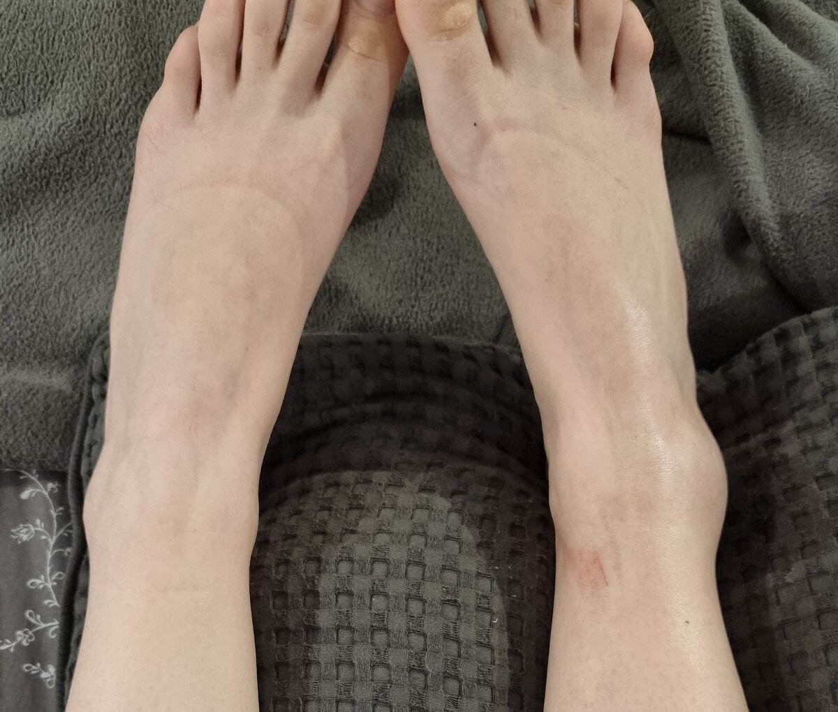 Правоя щиколотка. Заметно?!