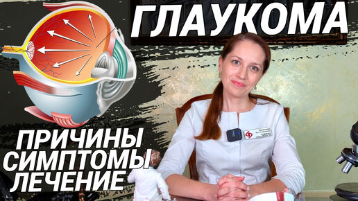 ГЛАУКОМА: как не ослепнуть? Что делать при давлении в глазах? Симптомы, причины, лечение глаукомы!