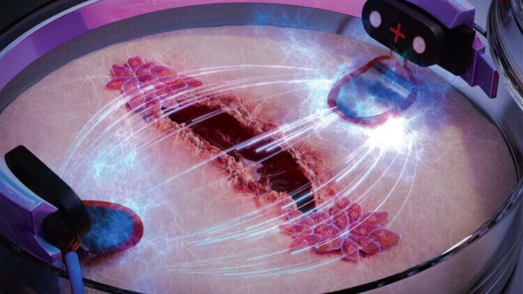    Электрическая стимуляция поможет ранам заживать быстрее / © Science Brush, Hassan A. Tahini