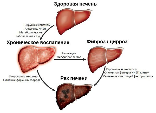 Классификация и формы патологического состояния