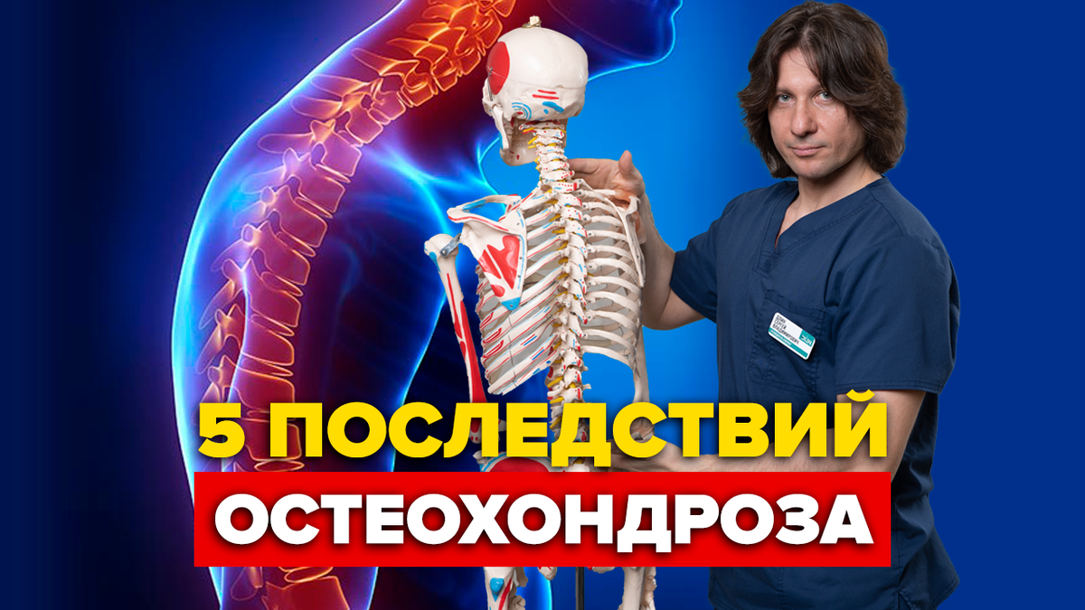 Капусту в рот – остеохондроз уйдёт: Эксперты раскрыли забытое средство от болей в спине