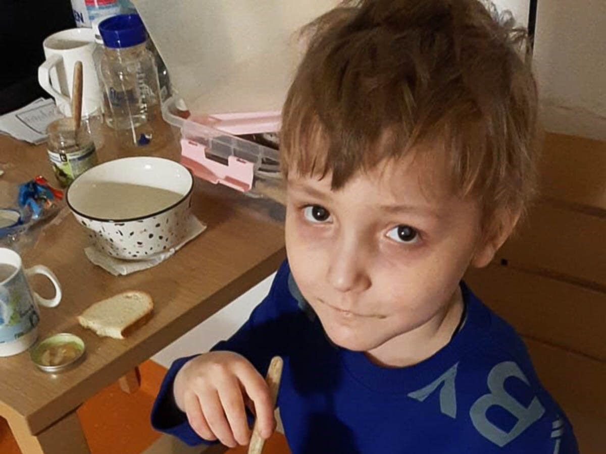Болезненный вид мальчика говорит о его тяжелом состоянии