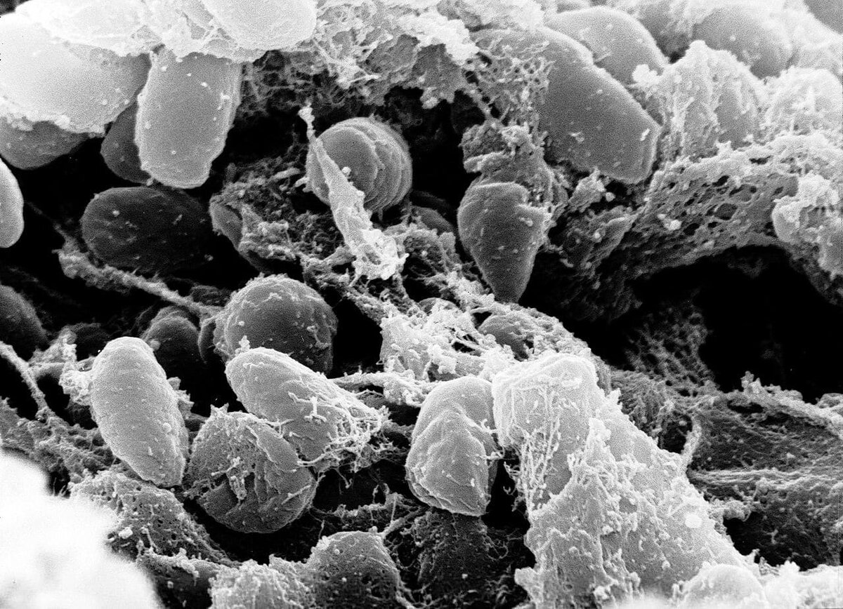    Yersinia pestis, электронная микрофотография / © Wikipedia