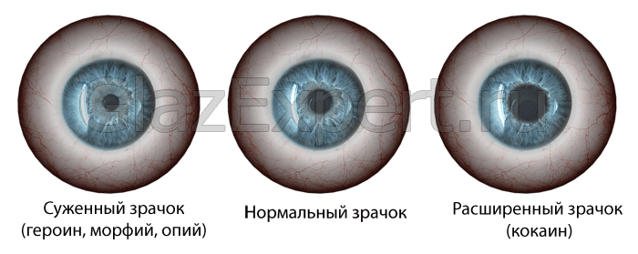 Внешность наркомана – особенности характера и манера поведения