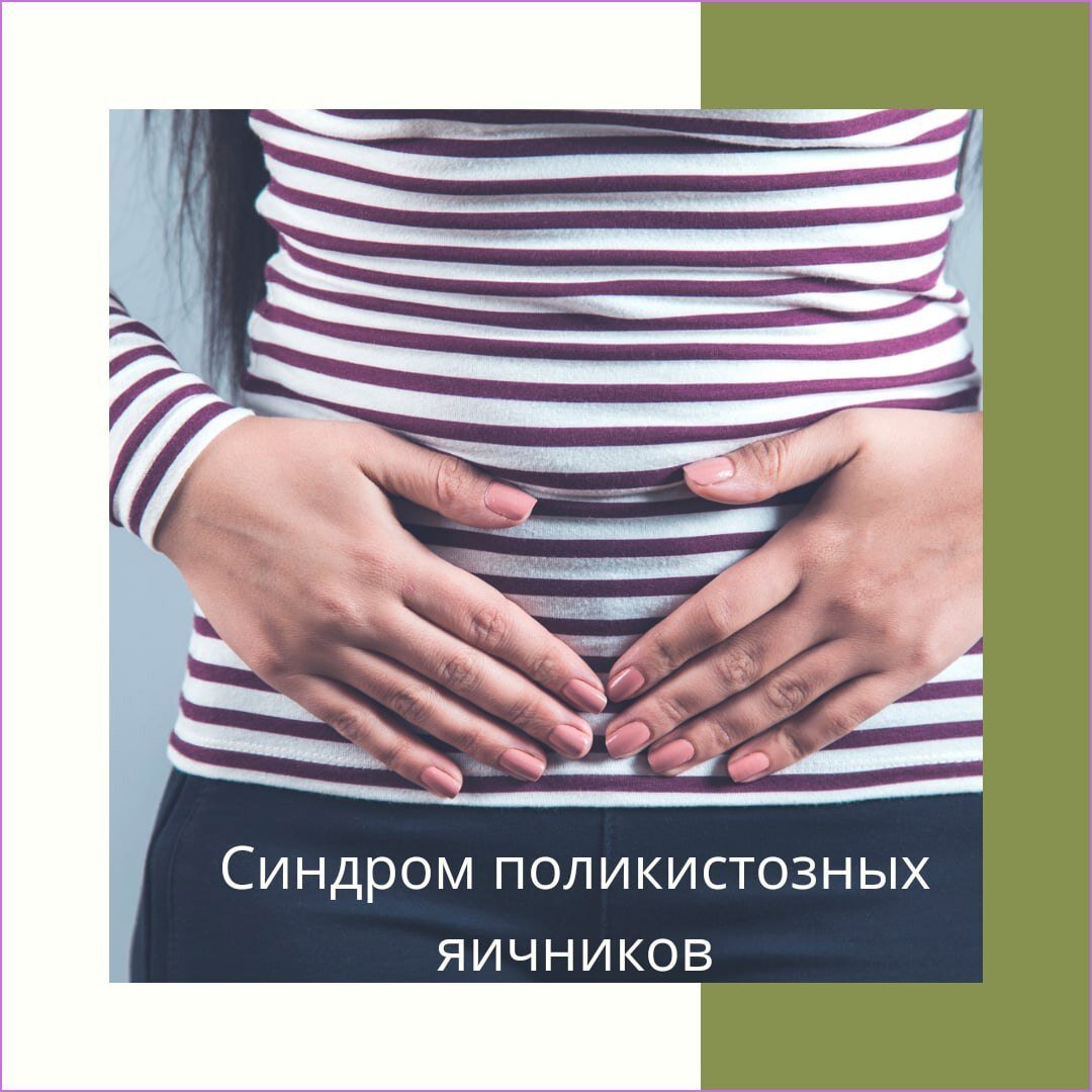 Синдром поликистозных яичников