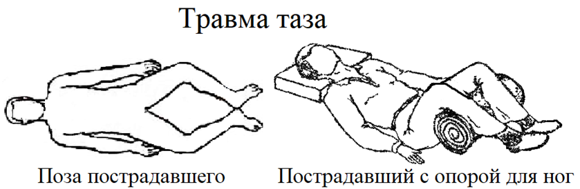 Каким образом осуществляется транспортировка с переломом позвоночника