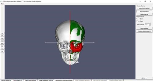 Результат поиска недостающего объема