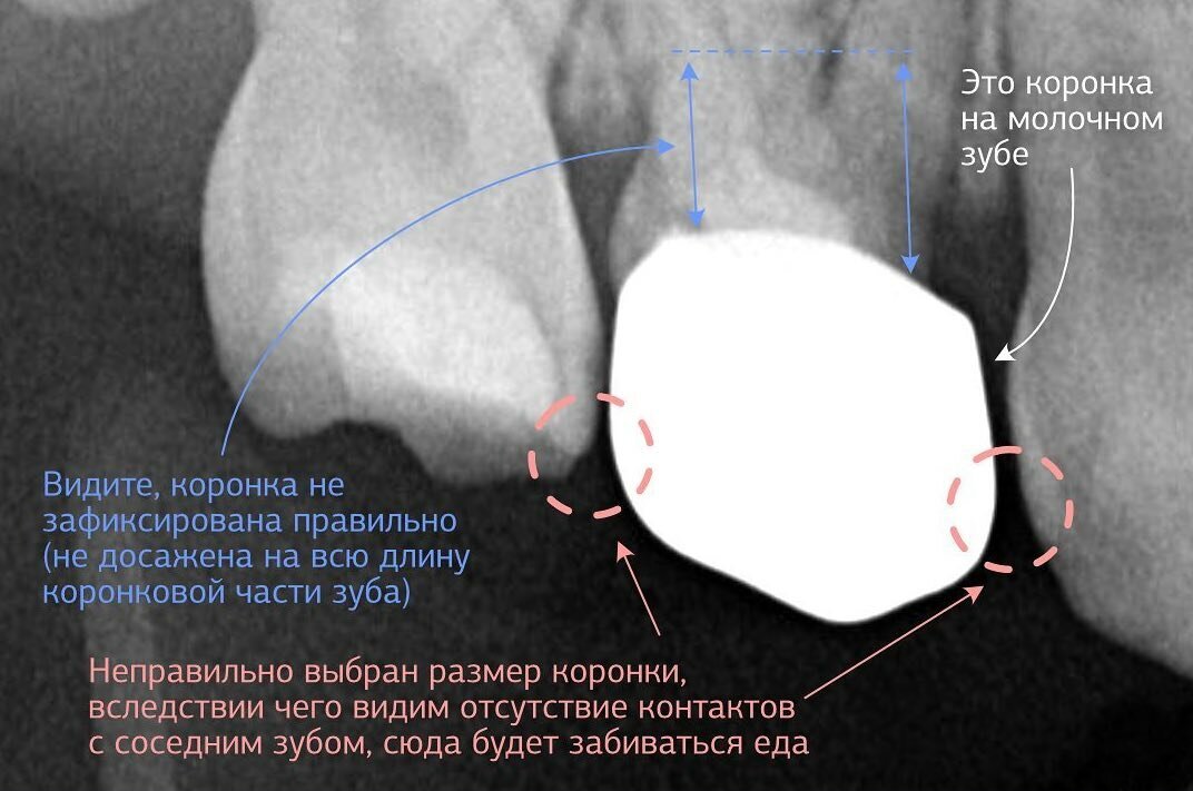 Добавьте описание