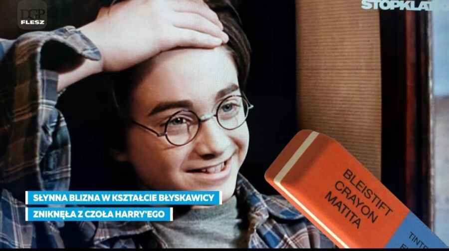 Польский Гарри Поттер после косметической операции