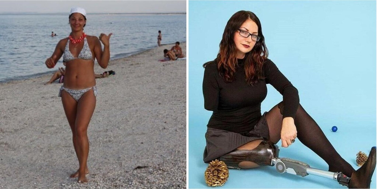 До и после аварии