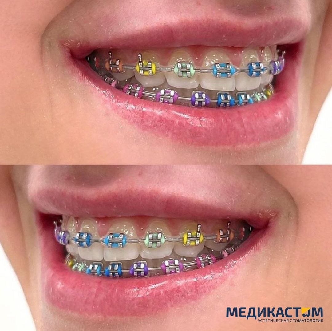 Наши специалисты учтут все особенности ротовой полости пациента, его индивидуальные особенности и даже финансовые возможности. 