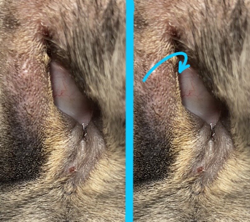 Классический заворот нижнего века. На фото видно как реснитчатый край завернулся в сторону глаза.