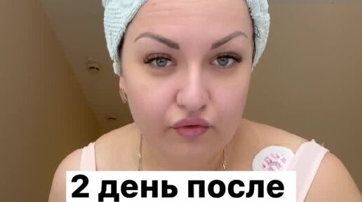 худеем после кесарева
