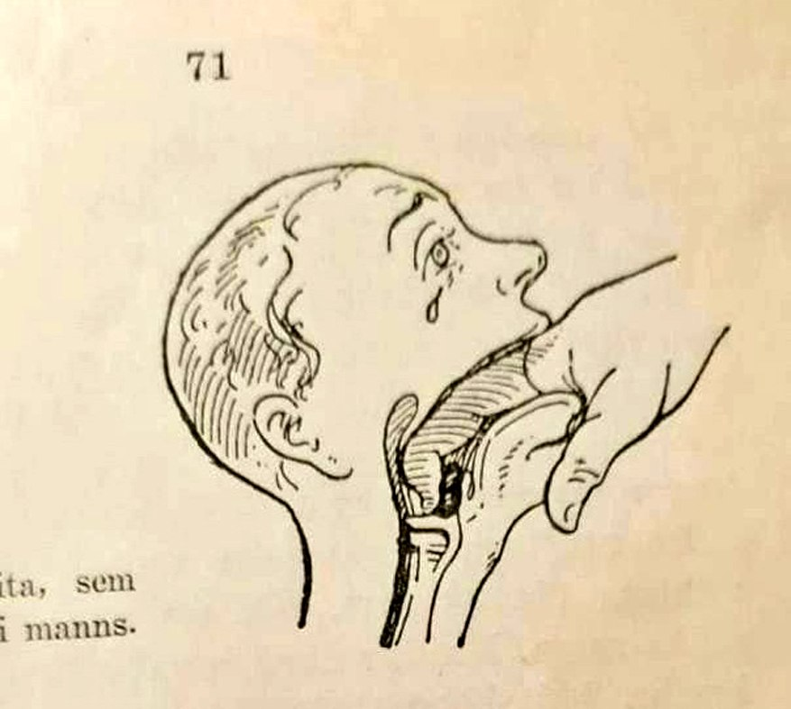 -2
