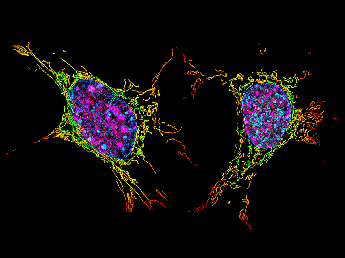 Клетки с гиперхромными ядрами. Сенесцентных, клеток. Fibroblast Family Cells. Защита клеток от старения. Картинки с клеточными лабораториями.