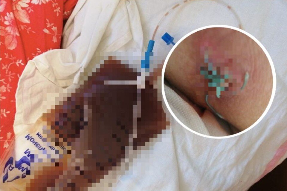    Неизвестный срезал тяжелобольному пациенту трубку из почки, он попал в больницу. Фото: Предоставлено героями публикации