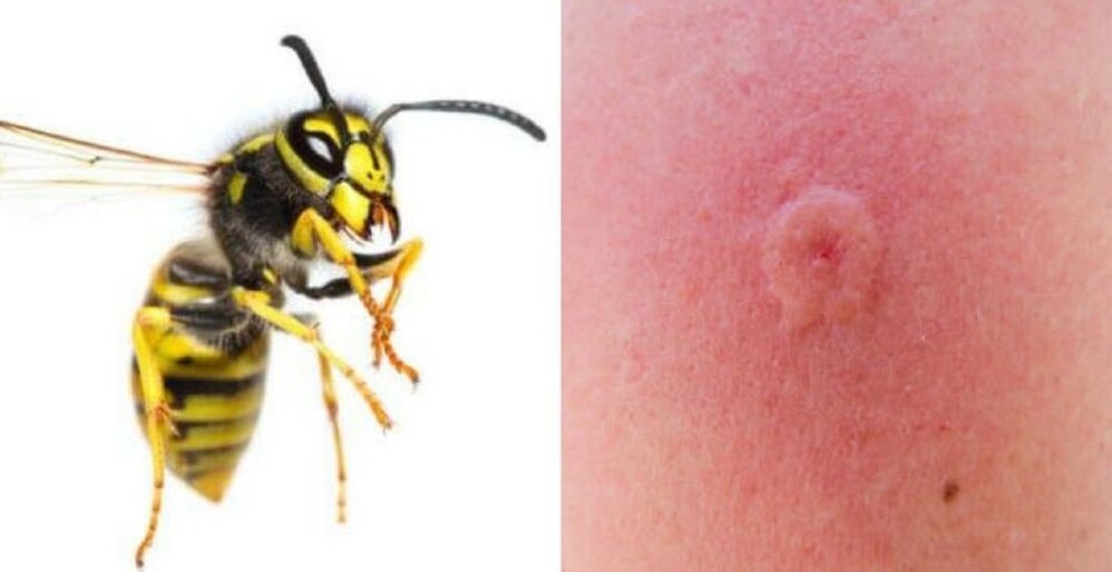 Токсиколог объяснил, чем может быть опасен укус осы. Спорт-Экспресс
