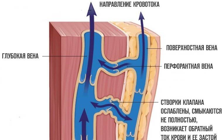 вытаптывания - эротика онлайн