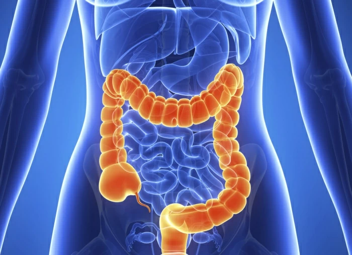 Ce este colita ulcerativă: care sunt cauzele inflamației, cum să recunoașteți și să tratați boala
