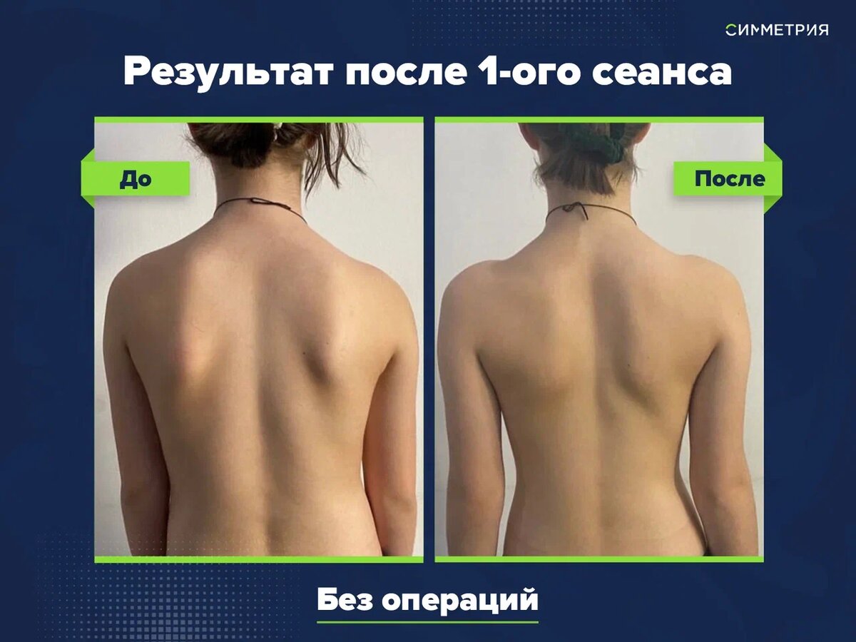 Как сохранить здоровье позвоночника простые советы