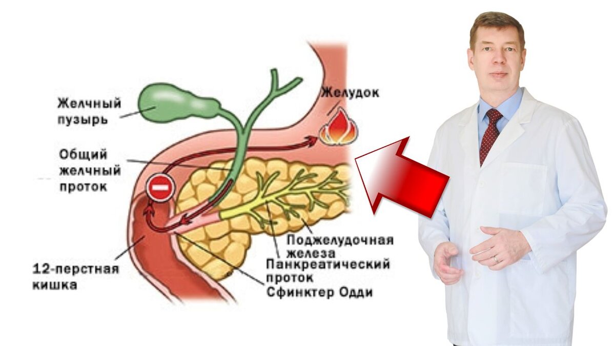 Заброс желчи в желудок и пищевод