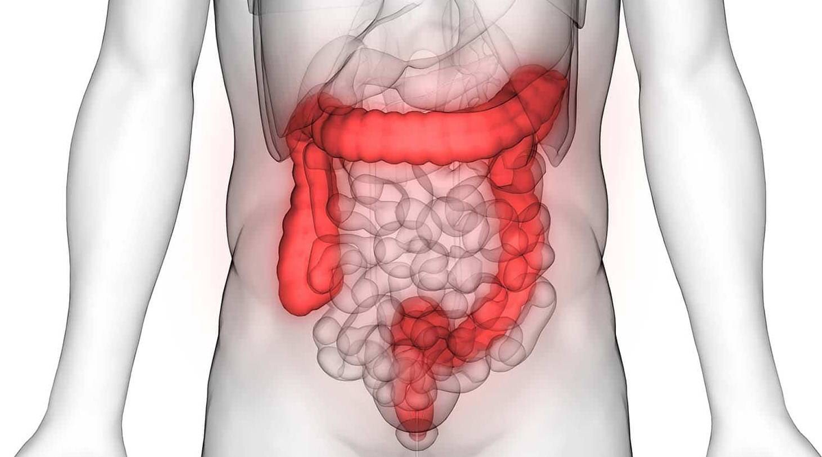 Ce este colita ulcerativă: care sunt cauzele inflamației, cum să recunoașteți și să tratați boala