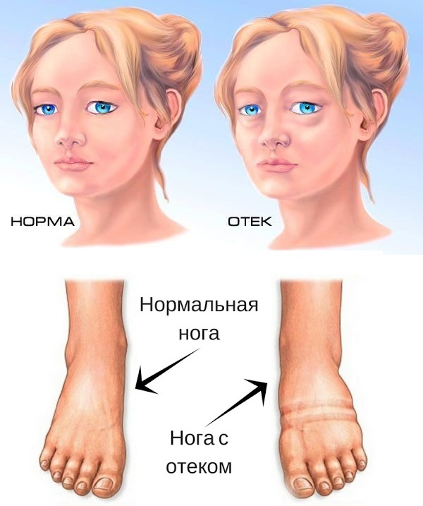 8 кричащих причин, указывающих на то, что ваши почки начинают ...