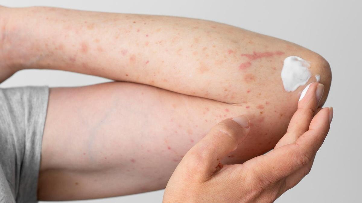    Травма:Freepik