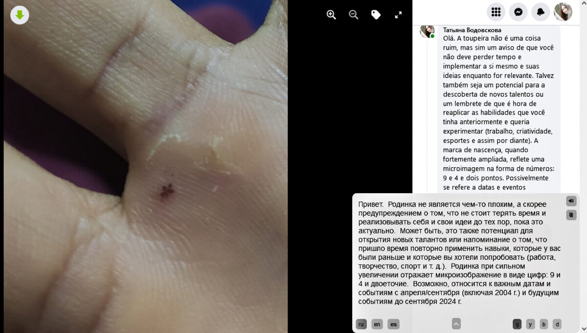 Вопрос о родинке между средним и безымянным пальцем. Продолжение диалога - листайте в галерее.