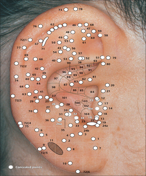 Фотографии точки. Ухо точки акупунктуры. Иглоукалывание точки на ушах. Рефлексотерапия ухо точки.