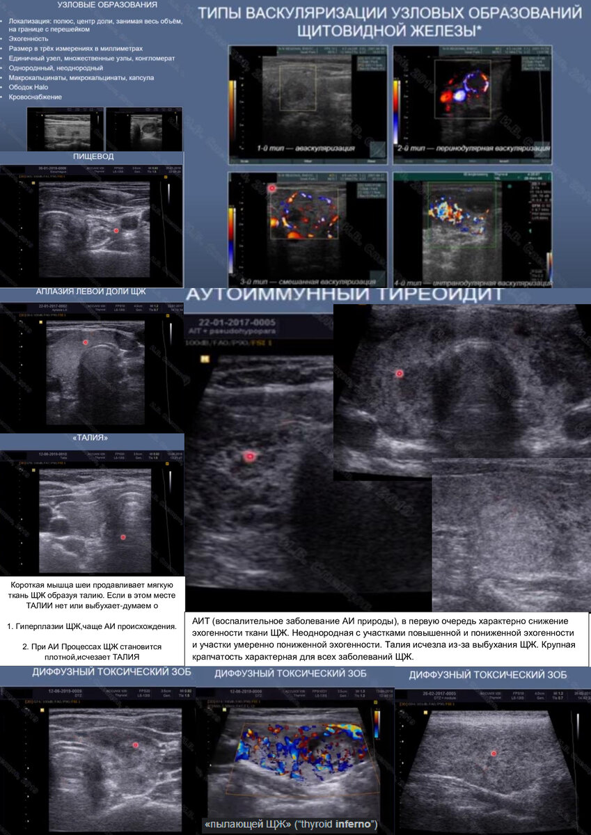 Для АИТ особенно характерна реакция паратрахеальных глубоких шейных на уровне нижних полюсов долей,  эти лимфоузлы реагируют практически в 100%. 
(При тиреоидитах "со стажем" там же зачастую видны "старые" с липоидно- фиброзной дегенерацией "белые" лимфатические узлы)

Средне- верхнешейные именно при АИТ могут не иметь отношения к щитовидной железе.
Лимфатические узлы выглядят как реактивные. На шее могут среагировать на что угодно, больные зубы, горло и тд. Контроль через месяц рекомендовать.