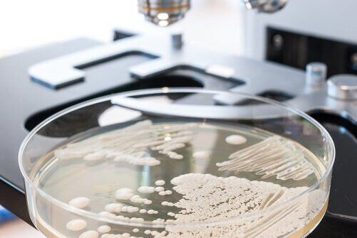 Картинка кандиды из Pinterest