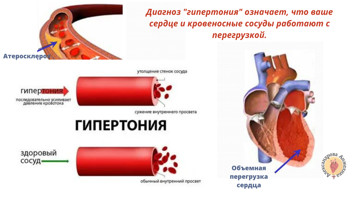 Зверь с высоким кровяным давлением