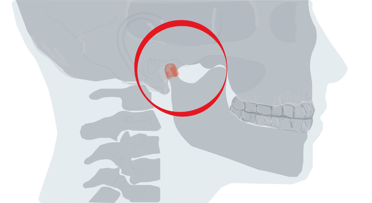 Заболевания ВНЧС