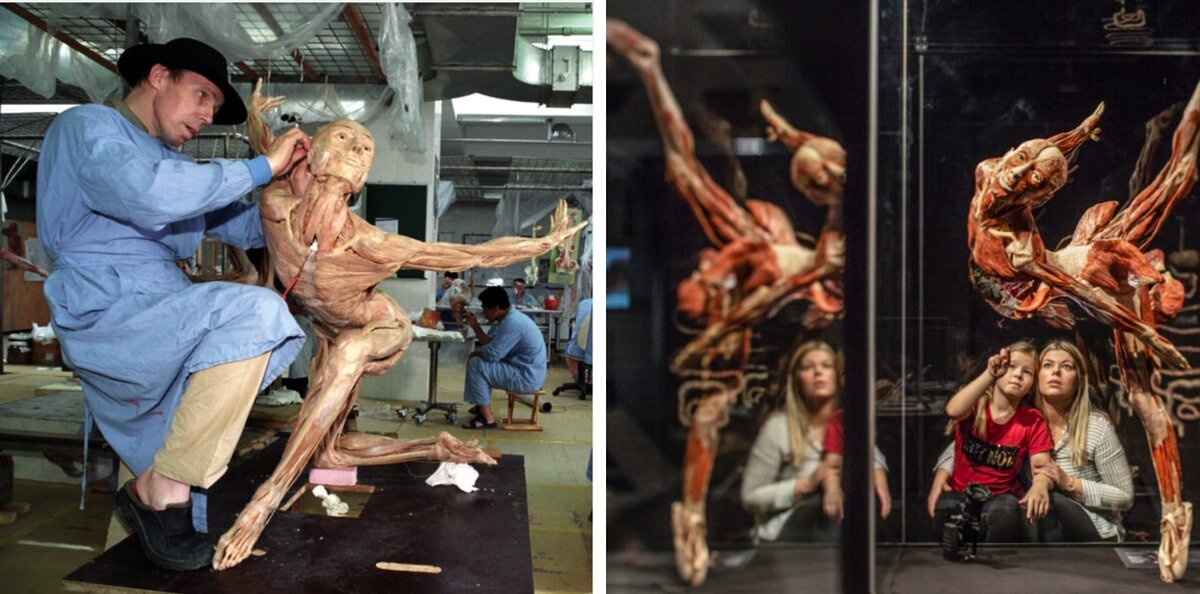 Экспонаты выставок Гюнтера фон Хагенса Body Worlds. 