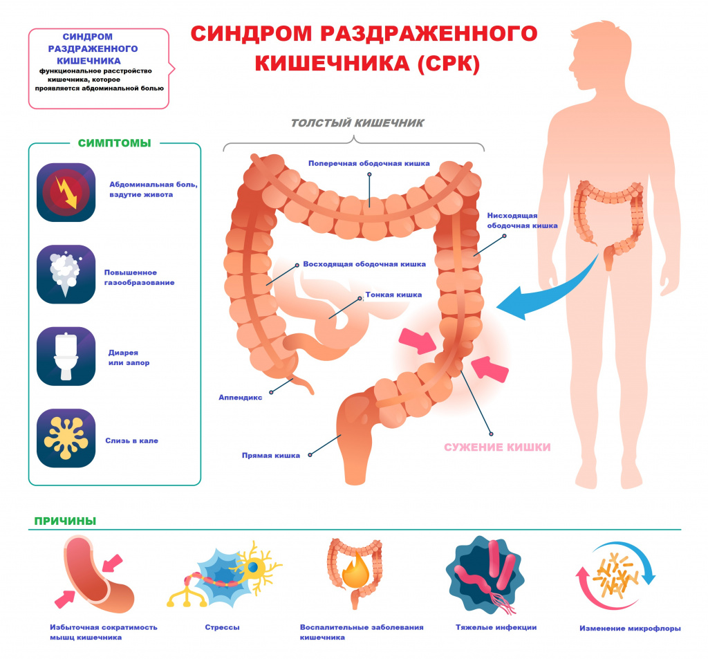 Нарушение кишечника причины. Функциональное расстройство кишечника. Синдром избыточного газообразования в кишечнике лечение. Боль в животе при СРК. Избыточный рост кала в организме.