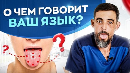 Download Video: О чем говорит внешний вид вашего языка? Как определить состояние организма по языку